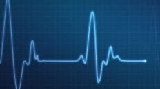 iphone heart rate monitor tinke