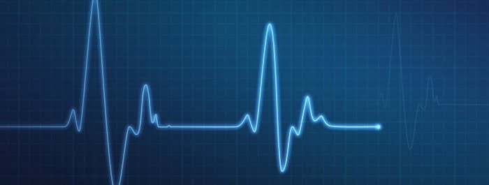 iphone heart rate monitor tinke